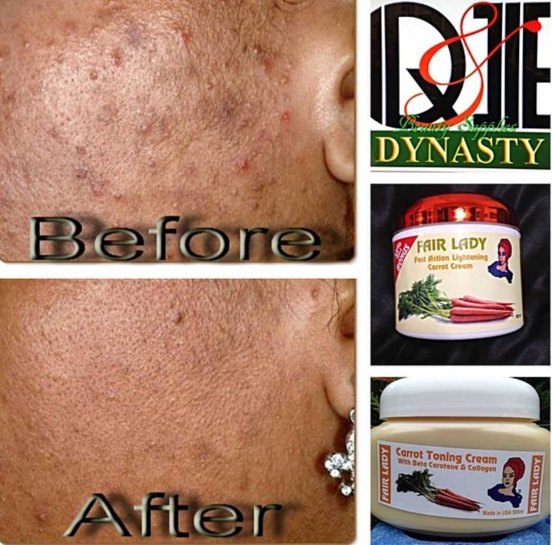 Face Moisturizers in Skin Care