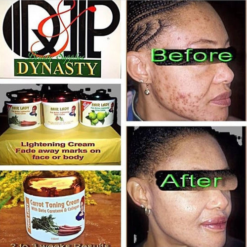 Face Moisturizers in Skin Care