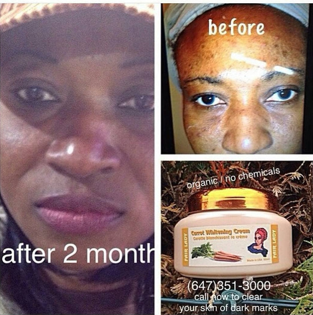 Face Moisturizers in Skin Care