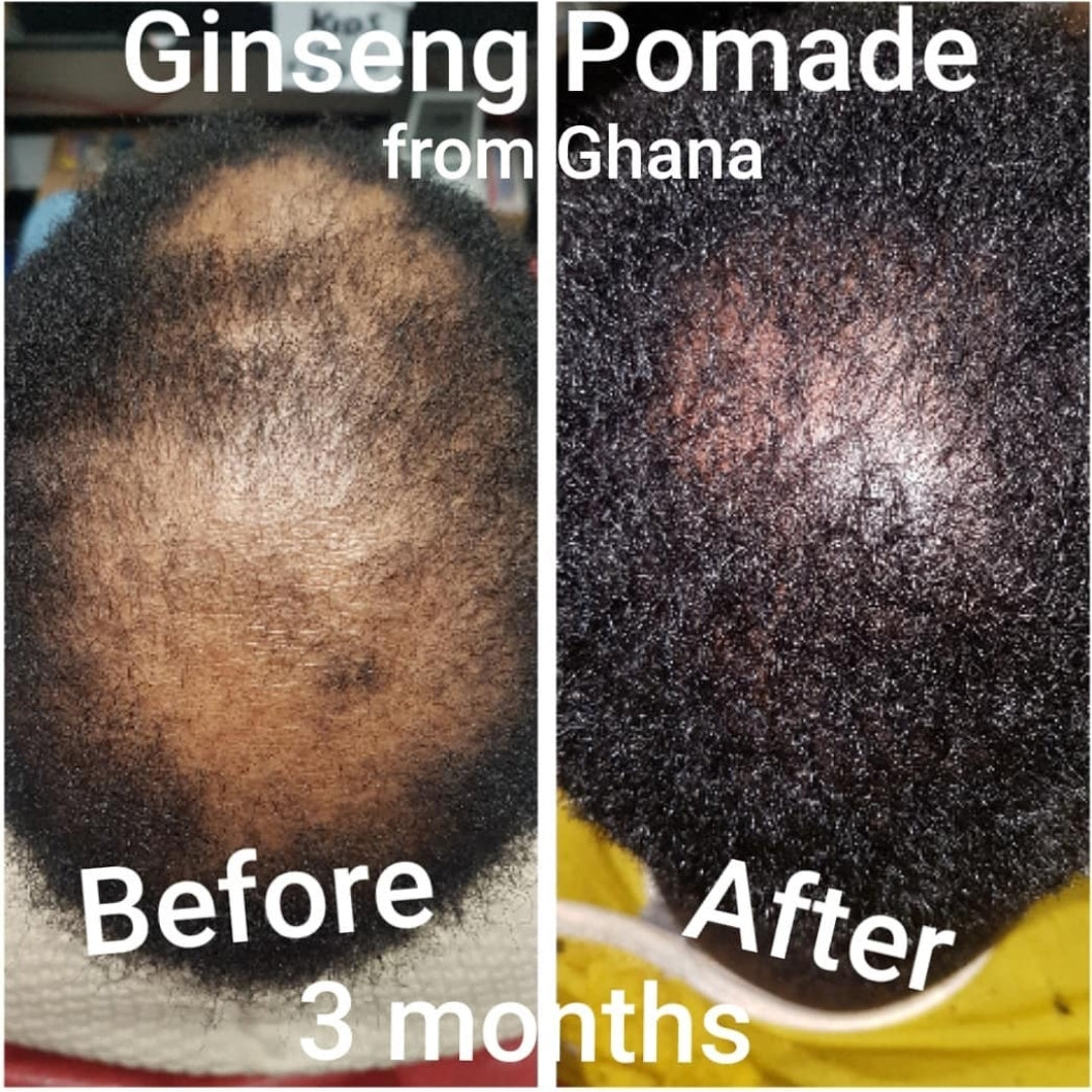 Hair Growth 100%